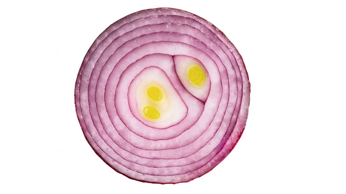 The Anatomy Of An Onion - Best Parts Of An Onion